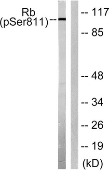 Rb (phospho Ser811) rabbit pAb Antibody