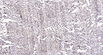 Rb (phospho Ser811) rabbit pAb Antibody