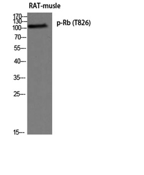 Rb (phospho Thr826) rabbit pAb Antibody