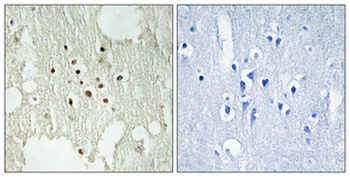 Rb (phospho Thr826) rabbit pAb Antibody