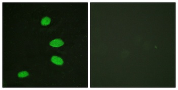 p130 rabbit pAb Antibody