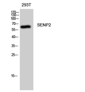 SENP2 rabbit pAb Antibody