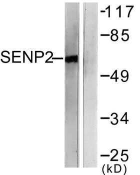 SENP2 rabbit pAb Antibody