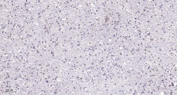 SENP2 rabbit pAb Antibody