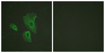 Bcl-2 (phospho Thr69) rabbit pAb Antibody
