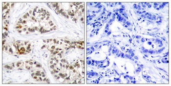 RelB (phospho Ser552) rabbit pAb Antibody