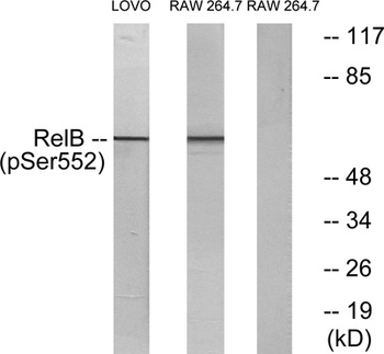 RelB (phospho Ser552) rabbit pAb Antibody