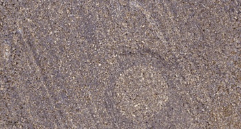 RelB rabbit pAb Antibody