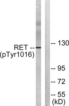 Ret (phospho Tyr1015) rabbit pAb Antibody