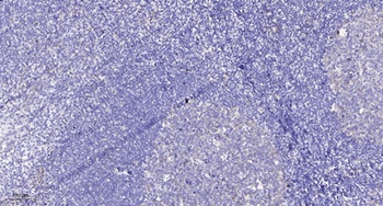 Ret (phospho Tyr1015) rabbit pAb Antibody