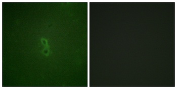 Bcl-x (phospho Thr47) rabbit pAb