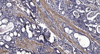 RFC2 rabbit pAb Antibody