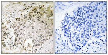 RFX2 rabbit pAb Antibody