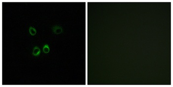 RGR rabbit pAb Antibody