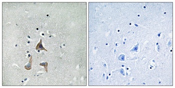 RGR rabbit pAb Antibody
