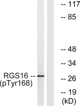RGS16 (phospho Tyr168) rabbit pAb Antibody
