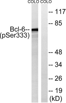 Bcl-6 (phospho Ser333) rabbit pAb Antibody