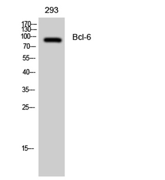 Bcl-6 rabbit pAb Antibody