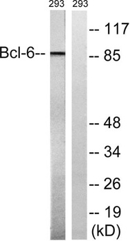 Bcl-6 rabbit pAb Antibody
