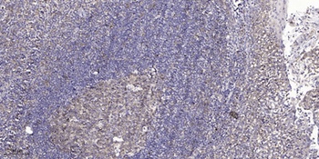 Bcl-6 rabbit pAb Antibody