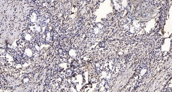 Tip5 rabbit pAb Antibody