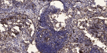 QM rabbit pAb Antibody