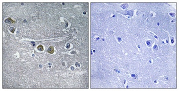 Ribosomal Protein L15 rabbit pAb Antibody