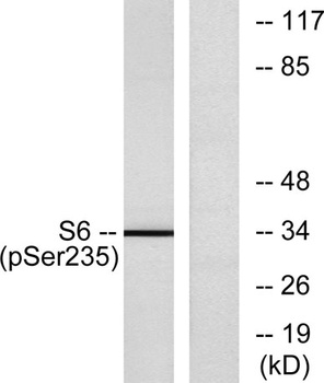 Ribosomal Protein S6 (phospho Ser235) rabbit pAb Antibody