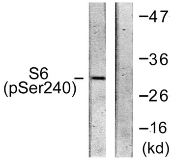 Ribosomal Protein S6 (phospho Ser240) rabbit pAb Antibody