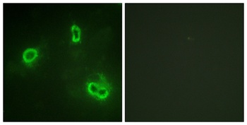 Rsk-1 rabbit pAb Antibody