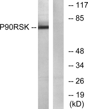 Rsk-1 rabbit pAb Antibody