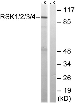 Rsk-1/2/3/4 rabbit pAb Antibody