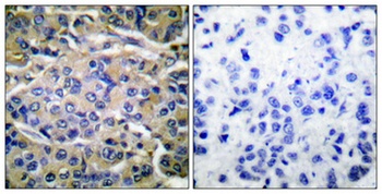 p70 S6 kinase α (phospho Thr421) rabbit pAb Antibody