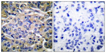 p70 S6 kinase α (phospho Thr421) rabbit pAb Antibody