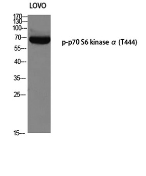 p70 S6 kinase α (phospho Thr444) rabbit pAb Antibody
