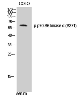 p70 S6 kinase α (phospho Ser371) rabbit pAb Antibody
