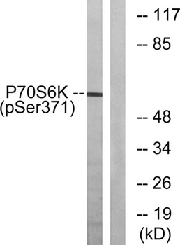 p70 S6 kinase α (phospho Ser371) rabbit pAb Antibody