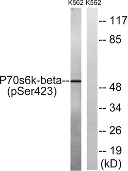p70 S6 kinase β (phospho Ser423) rabbit pAb Antibody
