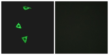 Bradykinin B1 R rabbit pAb Antibody