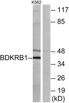 Bradykinin B1 R rabbit pAb Antibody