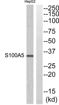 S-100A5 rabbit pAb Antibody