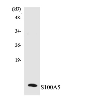 S-100A5 rabbit pAb Antibody