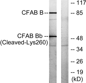 Cleaved-Factor B Bb (K260) rabbit pAb Antibody