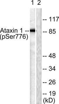 Ataxin-1 (phospho Ser776) rabbit pAb Antibody