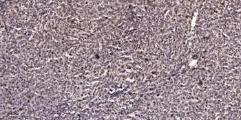 Ataxin-1 (phospho Ser776) rabbit pAb Antibody