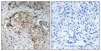 ENaC β (phospho Thr615) rabbit pAb Antibody