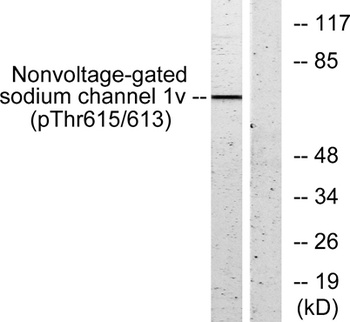 ENaC β (phospho Thr615) rabbit pAb Antibody