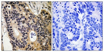 ENaC β rabbit pAb Antibody