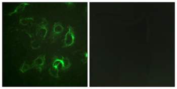 ENaC β rabbit pAb Antibody