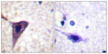 BID (phospho Ser78) rabbit pAb Antibody
